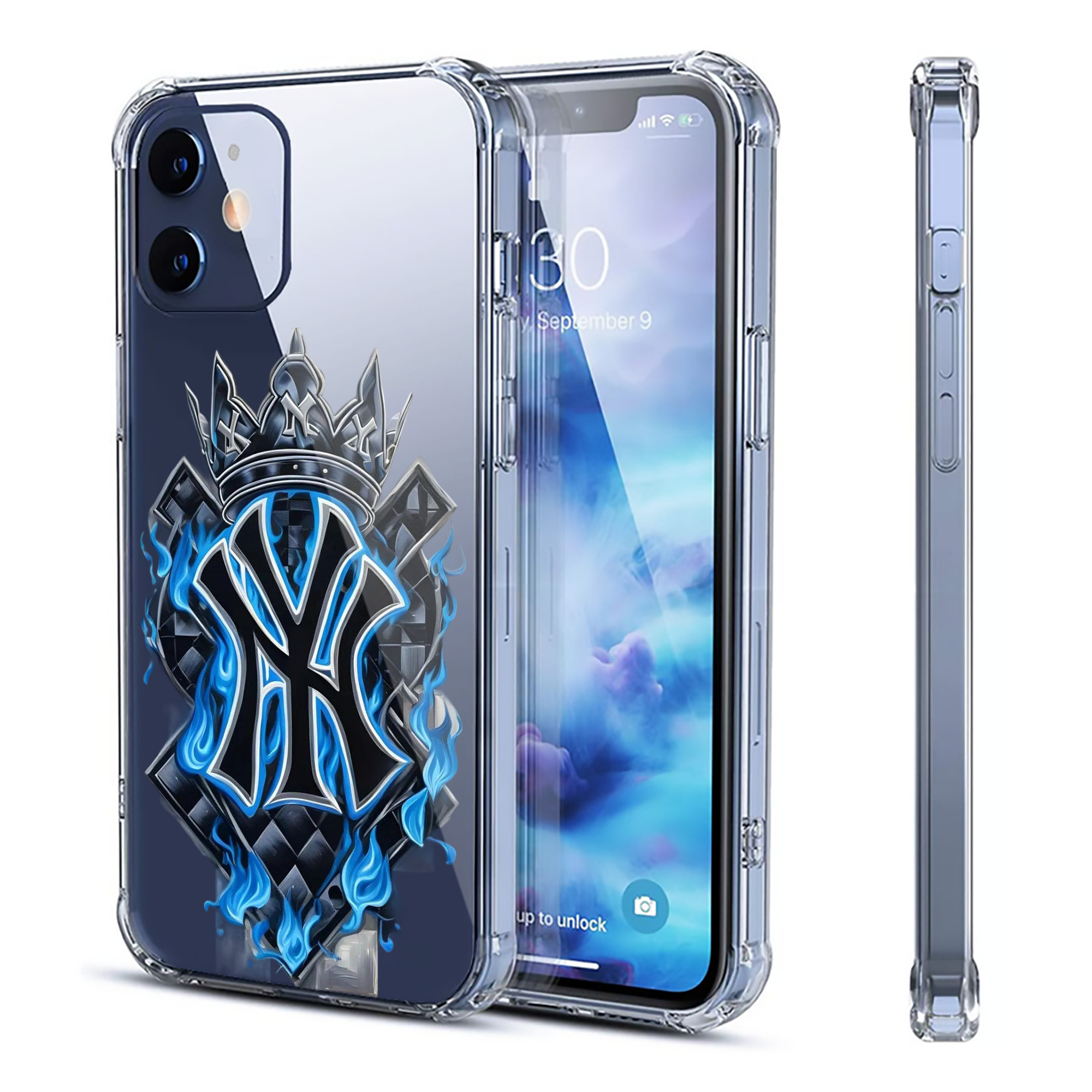 New York Yankees 285 Clear IPhone 12 Case – Soft TPU With UV Print – Enhanced Drop Protection, Precise Fit, Anti-Fingerprint, Customizable Design, Scratch-Resistant, Yellow-Resistant
